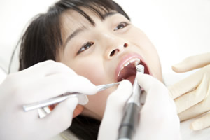 小児歯科クリーニング